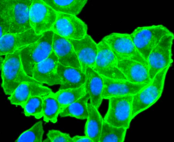 Alpha smooth muscle Actin Recombinant Rabbit Monoclonal Antibody