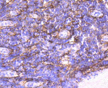 Alpha smooth muscle Actin Recombinant Rabbit Monoclonal Antibody