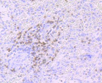 CD3 gamma Recombinant Rabbit Monoclonal Antibody