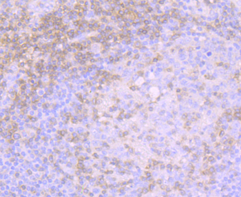 CD3 gamma Recombinant Rabbit Monoclonal Antibody