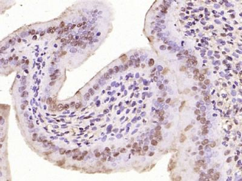 Phospho C-Myc (Thr58 / Ser62) Rabbit Polyclonal Antibody