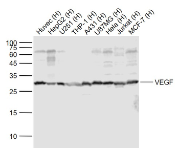 VEGF Rabbit Polyclonal Antibody