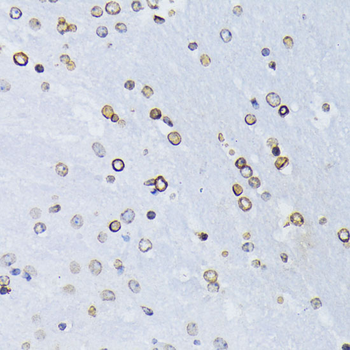 Lamin B1 Rabbit Polyclonal Antibody