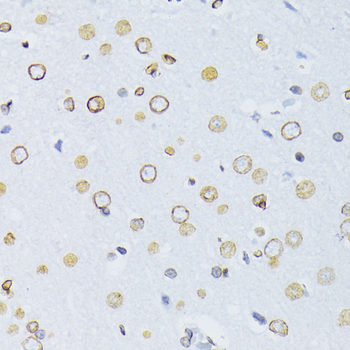 Lamin B1 Rabbit Polyclonal Antibody