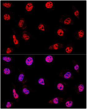 HDAC1 Rabbit Polyclonal Antibody