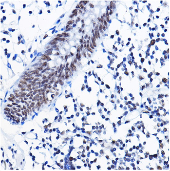 HDAC1 Rabbit Polyclonal Antibody