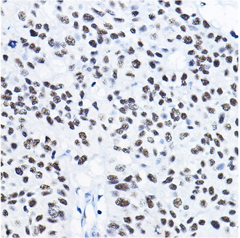 HDAC1 Rabbit Polyclonal Antibody
