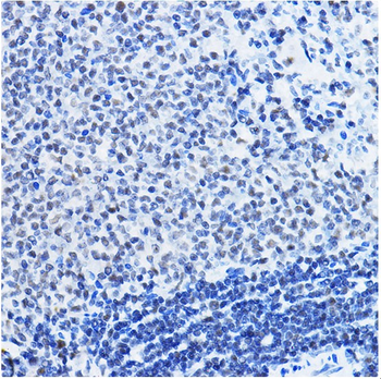 HDAC1 Rabbit Polyclonal Antibody