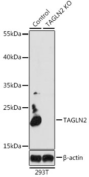 TAGLN2 Rabbit Polyclonal Antibody