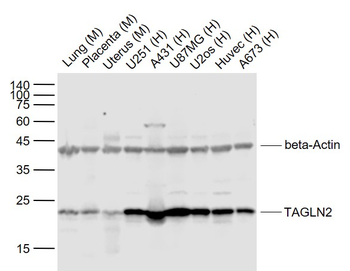 TAGLN2 Rabbit Polyclonal Antibody