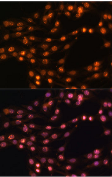 SUZ12 Rabbit Polyclonal Antibody