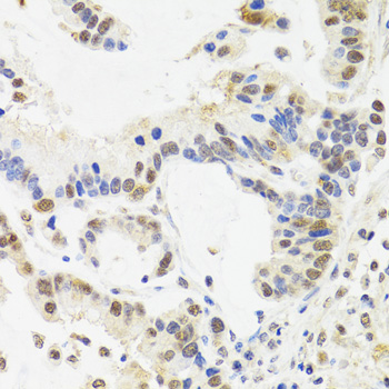 SUZ12 Rabbit Polyclonal Antibody