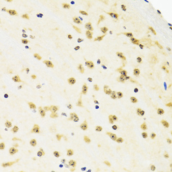 SUZ12 Rabbit Polyclonal Antibody