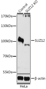 SUZ12 Rabbit Polyclonal Antibody