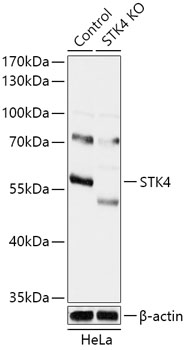 STK4 Rabbit Polyclonal Antibody