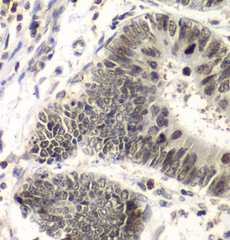 SMARCA4 Rabbit Polyclonal Antibody