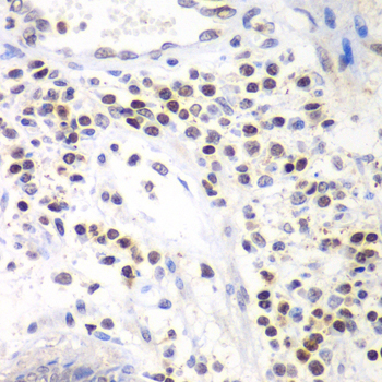 SMARCA4 Rabbit Polyclonal Antibody