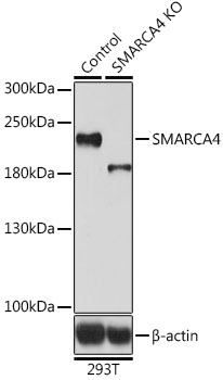 SMARCA4 Rabbit Polyclonal Antibody