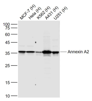 Annexin A2 (2F4) Recombinant Rabbit Monoclonal Antibody