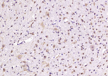 Synapsin II Rabbit Polyclonal Antibody