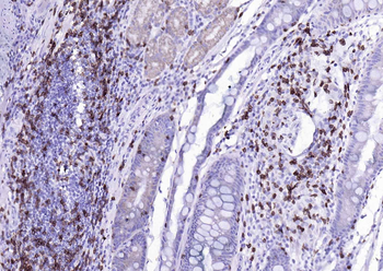 CD3 epsilon Recombinant Rabbit Monoclonal Antibody