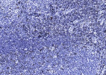 CD3 epsilon Recombinant Rabbit Monoclonal Antibody