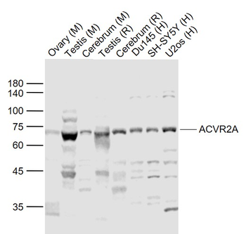ACVR2A Rabbit Polyclonal Antibody