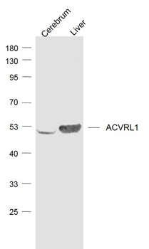 ACVRL1 Rabbit Polyclonal Antibody