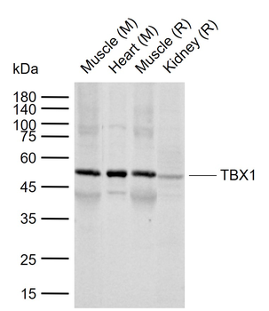 TBX1 Rabbit Polyclonal Antibody