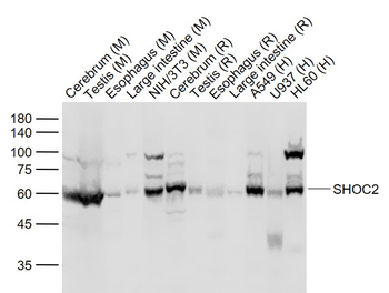 SHOC2 Rabbit Polyclonal Antibody
