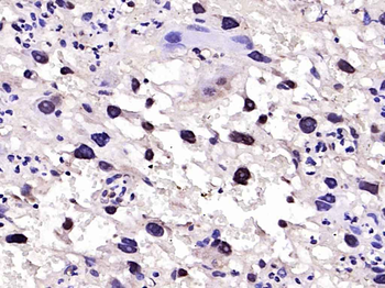 HAND2 Rabbit Polyclonal Antibody
