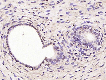 RSL1D1 Rabbit Polyclonal Antibody