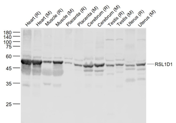 RSL1D1 Rabbit Polyclonal Antibody