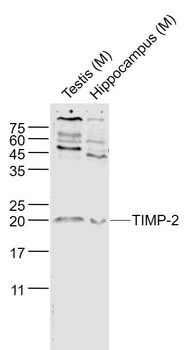 TIMP-2 antibody