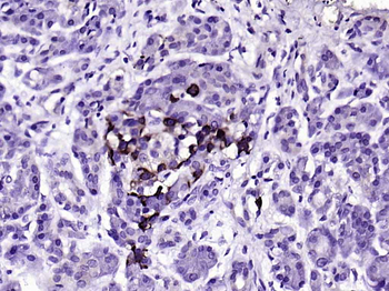 TTR/Prealbumin Mouse Monoclonal Antibody