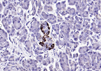 TTR/Prealbumin Mouse Monoclonal Antibody