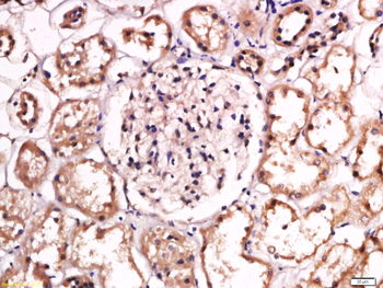 SPTBN2 Rabbit Polyclonal Antibody