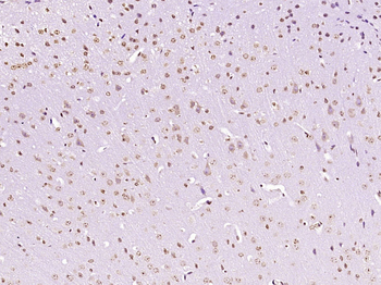 NET1 Rabbit Polyclonal Antibody