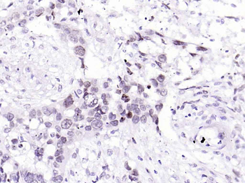 BANF1 Recombinant Rabbit Monoclonal Antibody