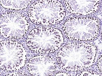 BANF1 Recombinant Rabbit Monoclonal Antibody