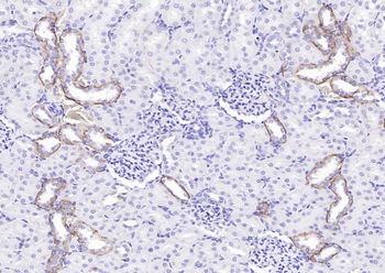EGFR Rabbit Polyclonal Antibody