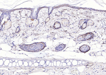 EGFR Rabbit Polyclonal Antibody