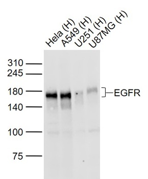 EGFR antibody