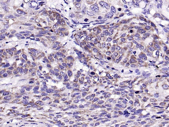 PAR-2 Rabbit Polyclonal Antibody