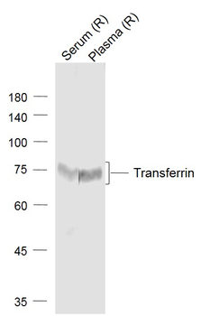Transferrin Mouse Monoclonal Antibody