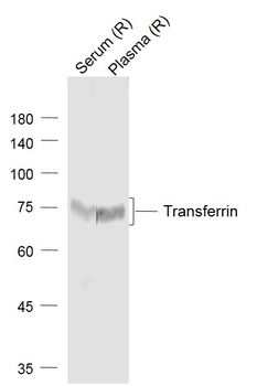 Transferrin antibody