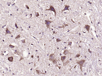 PMCA3 Rabbit Polyclonal Antibody