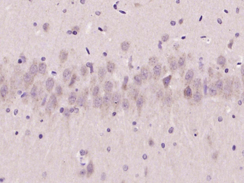 PMCA3 Rabbit Polyclonal Antibody