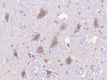 PMCA3 Rabbit Polyclonal Antibody