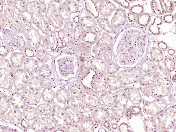 KDM1/LSD1 Rabbit Polyclonal Antibody